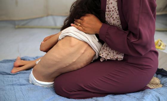 خسائر-فادحة-بين-المدنيين-في-غزة،-وسرقة-أغذية-علاجية مخصصة-للأطفال-الجوعى
