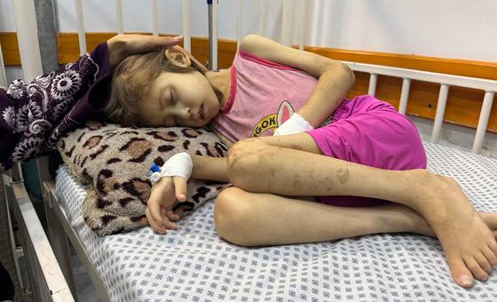 غزة-–-“العالم-تخلى-عن-جنى”:-لقيت-مصرعها-بسبب-سوء-التغذية