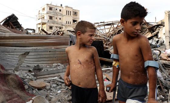 “انفجار-بين-الركام”،-شقيقان-من-غزة-يرويان-لحظات-تركت-ندوبا-غائرة-على-جسديهما