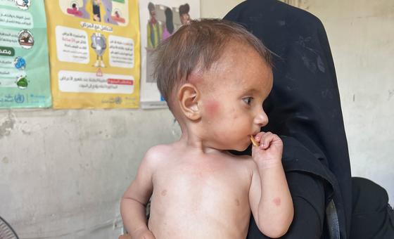 سوريا-–-الملايين-تأثروا-بخفض-تمويل-الخدمات-الصحية،-“جسر-تعافي”-البلاد-غدا