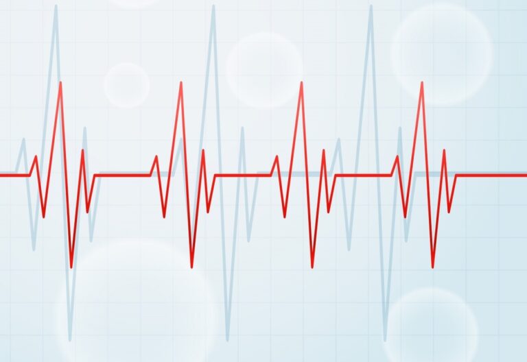 على-عمق-نحو-7-كيلومترات-زلزال-بقوة-4.7-درجة-يضرب-جنوب-تركيا
