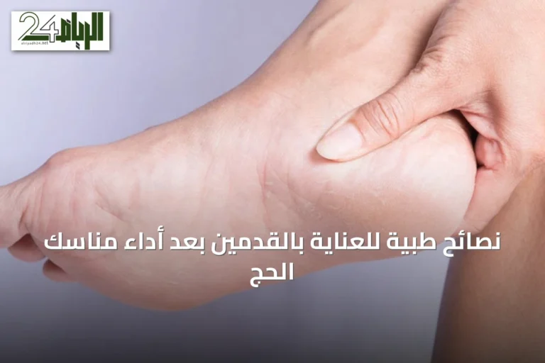 نصائح طبية للعناية بالقدمين بعد أداء مناسك الحج