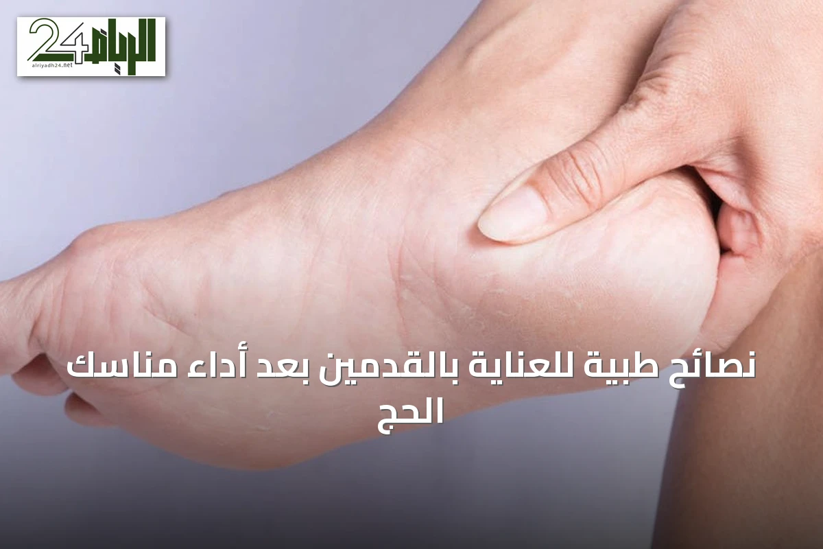 نصائح طبية للعناية بالقدمين بعد أداء مناسك الحج