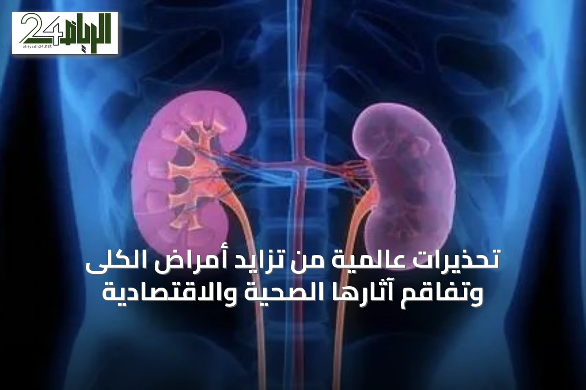 تحذيرات عالمية من تزايد أمراض الكلى وتفاقم آثارها الصحية والاقتصادية