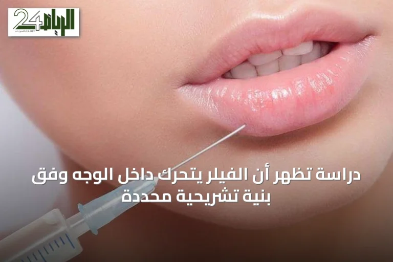 دراسة تُظهر أن الفيلر يتحرك داخل الوجه وفق بنية تشريحية محددة