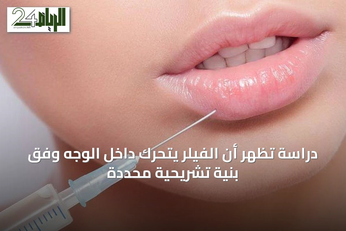 دراسة تُظهر أن الفيلر يتحرك داخل الوجه وفق بنية تشريحية محددة