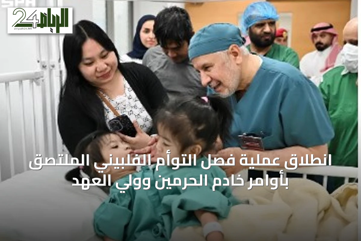 انطلاق عملية فصل التوأم الفلبيني الملتصق بأوامر خادم الحرمين وولي العهد
