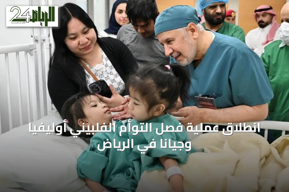 انطلاق عملية فصل التوأم الفلبيني أوليفيا وجيانا في الرياض