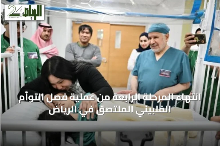انتهاء المرحلة الرابعة من عملية فصل التوأم الفلبيني الملتصق في الرياض