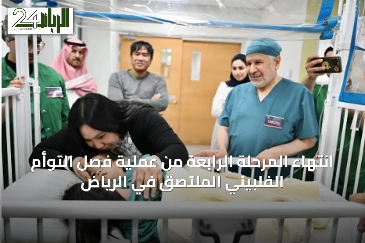 انتهاء المرحلة الرابعة من عملية فصل التوأم الفلبيني الملتصق في الرياض