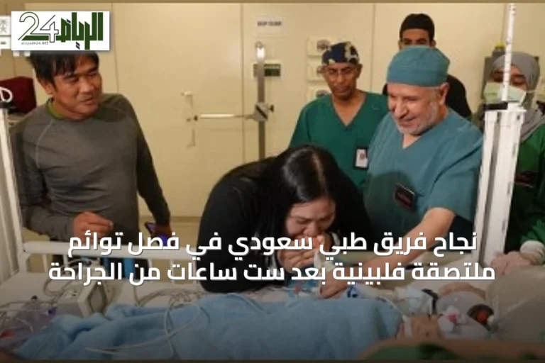 نجاح فريق طبي سعودي في فصل توائم ملتصقة فلبينية بعد ست ساعات من الجراحة