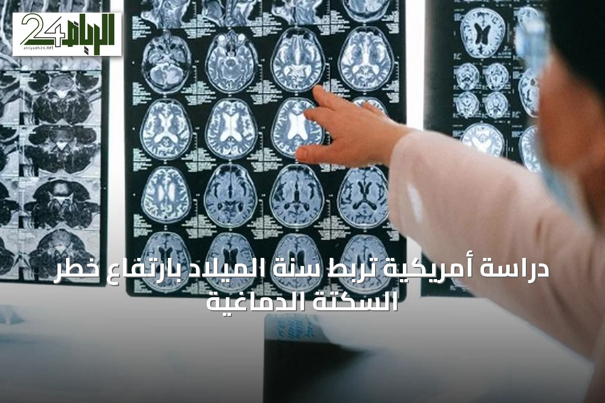 دراسة أمريكية تربط سنة الميلاد بارتفاع خطر السكتة الدماغية