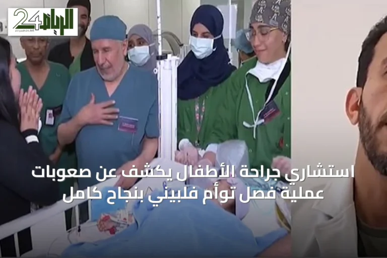 استشاري جراحة الأطفال يكشف عن صعوبات عملية فصل توأم فلبيني بنجاح كامل