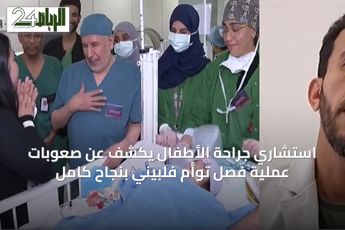 استشاري جراحة الأطفال يكشف عن صعوبات عملية فصل توأم فلبيني بنجاح كامل