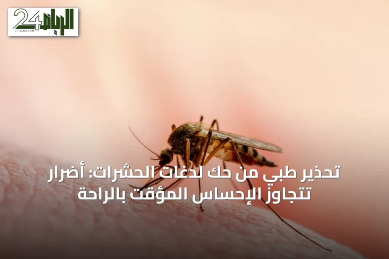 تحذير طبي من حك لدغات الحشرات: أضرار تتجاوز الإحساس المؤقت بالراحة