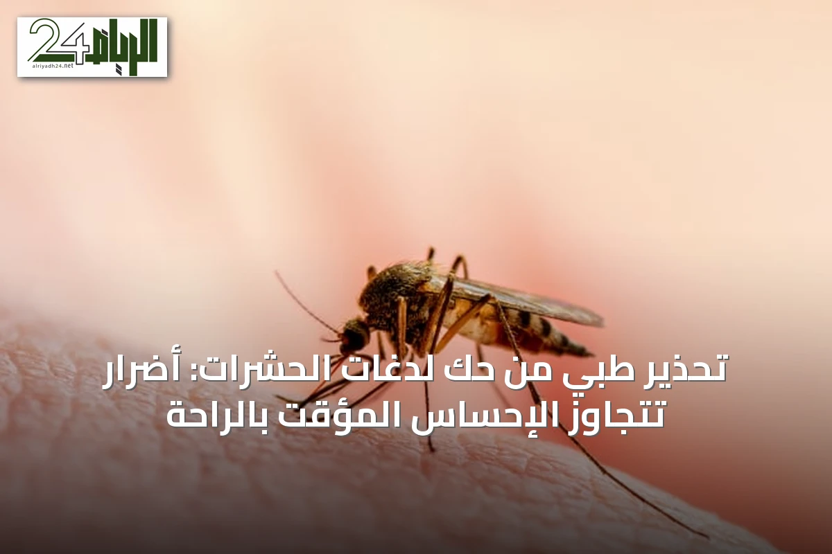 تحذير طبي من حك لدغات الحشرات: أضرار تتجاوز الإحساس المؤقت بالراحة