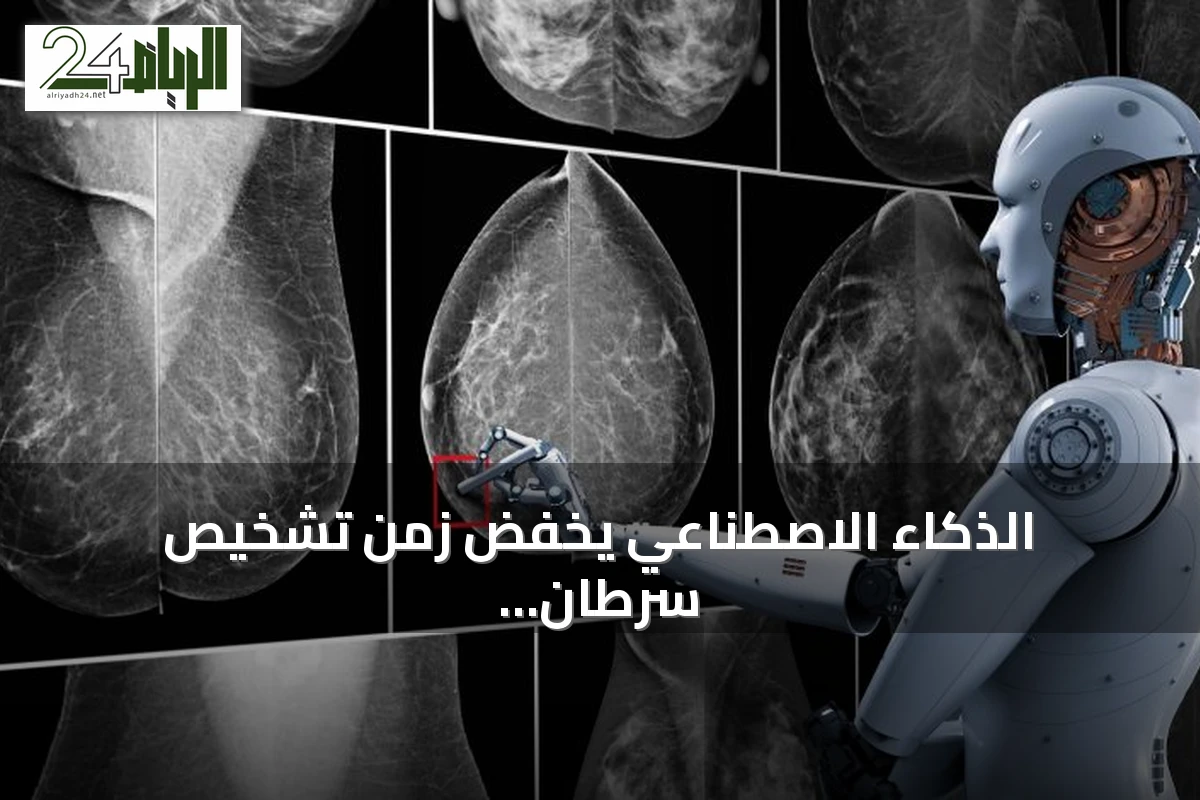 الذكاء الاصطناعي يخفّض زمن تشخيص سرطان الثدي من أسابيع إلى ساعة