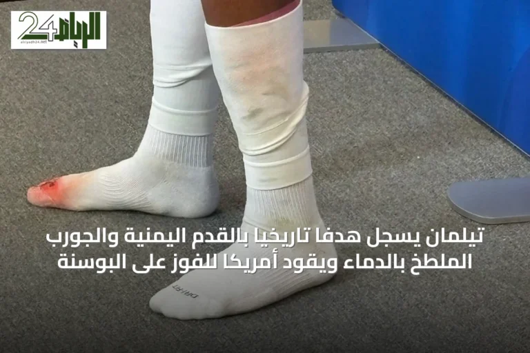 تيلمان يسجل هدفاً تاريخياً بالقدم اليمنية والجورب الملطخ بالدماء ويقود أمريكا للفوز على البوسنة