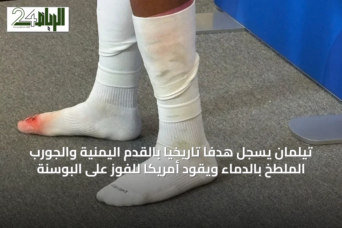 تيلمان يسجل هدفاً تاريخياً بالقدم اليمنية والجورب الملطخ بالدماء ويقود أمريكا للفوز على البوسنة