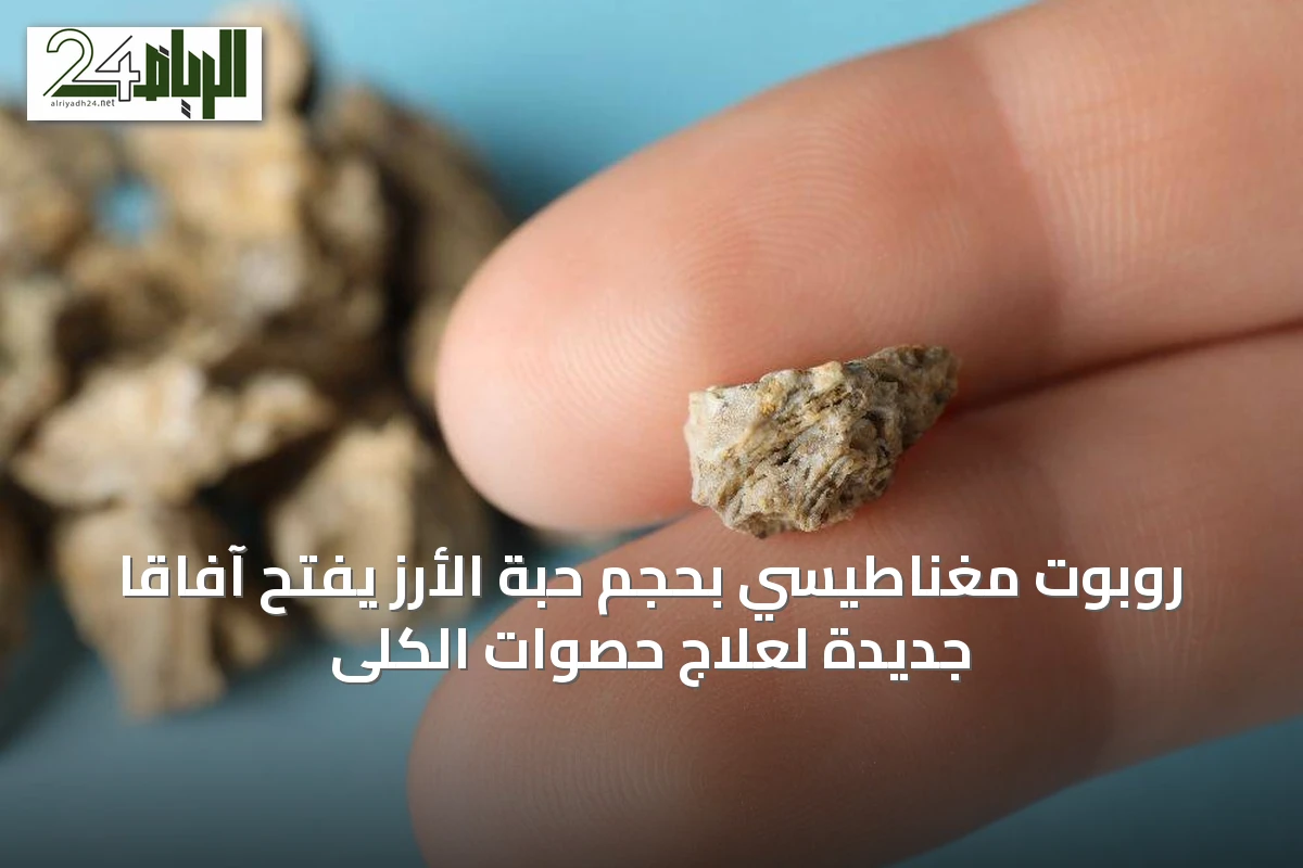 روبوت مغناطيسي بحجم حبة الأرز يفتح آفاقًا جديدة لعلاج حصوات الكلى