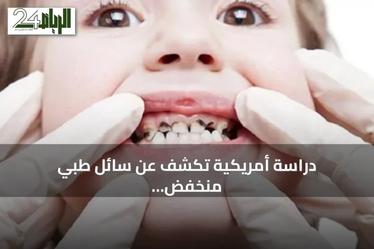 دراسة أمريكية تكشف عن سائل طبي منخفض التكلفة يوقف تسوس أسنان الأطفال دون حفر أو حقن
