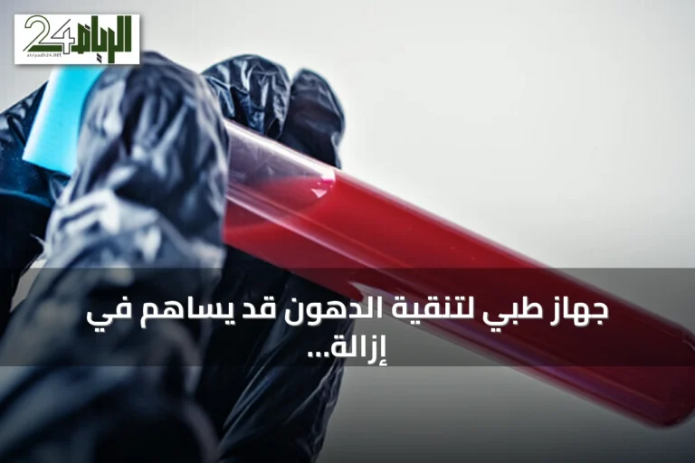 جهاز طبي لتنقية الدهون قد يساهم في إزالة الملوثات الأبدية من الدم
