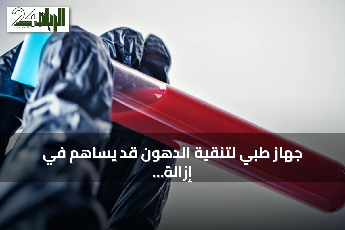 جهاز طبي لتنقية الدهون قد يساهم في إزالة الملوثات الأبدية من الدم