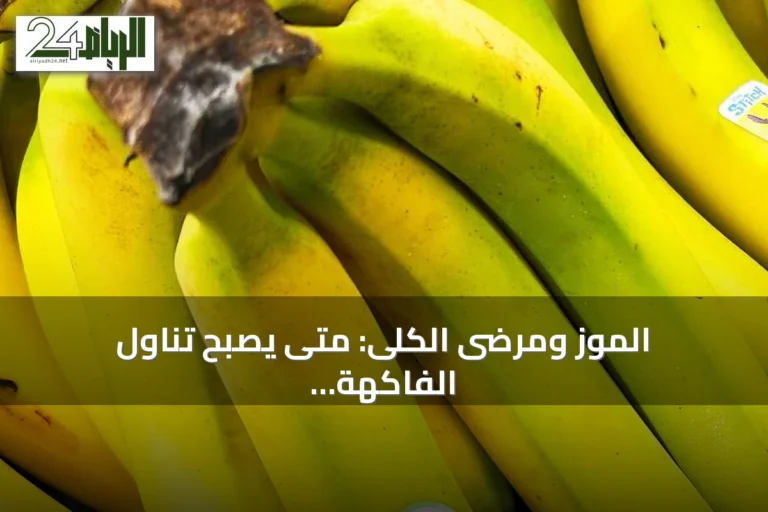 الموز ومرضى الكلى: متى يصبح تناول الفاكهة خطراً؟