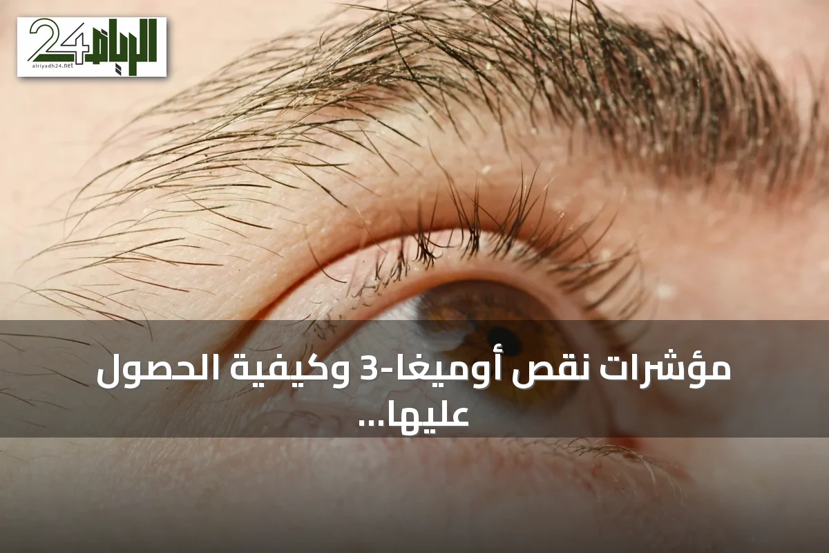 مؤشرات نقص أوميغا-3 وكيفية الحصول عليها من الغذاء