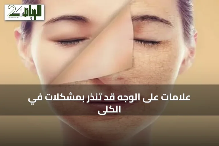 علامات على الوجه قد تنذر بمشكلات في الكلى