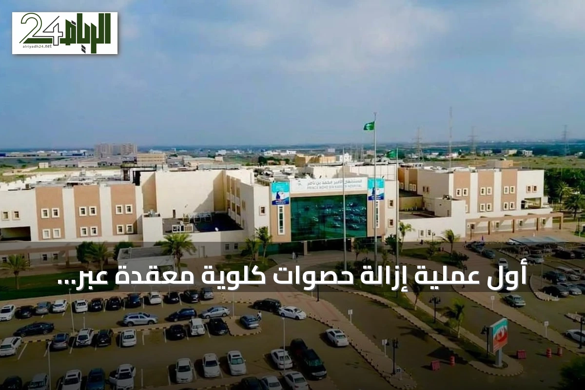 أول عملية إزالة حصوات كلوية معقدة عبر الجلد تُنجز في مستشفى الأمير محمد بن ناصر بجازان