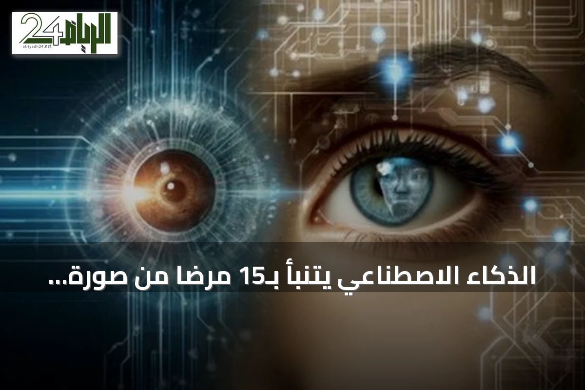 الذكاء الاصطناعي يتنبأ بـ15 مرضاً من صورة شبكية العين قبل ظهور الأعراض