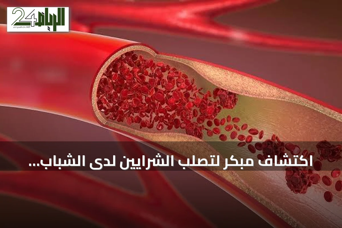 اكتشاف مبكر لتصلب الشرايين لدى الشباب يكشف عن خطر صامت