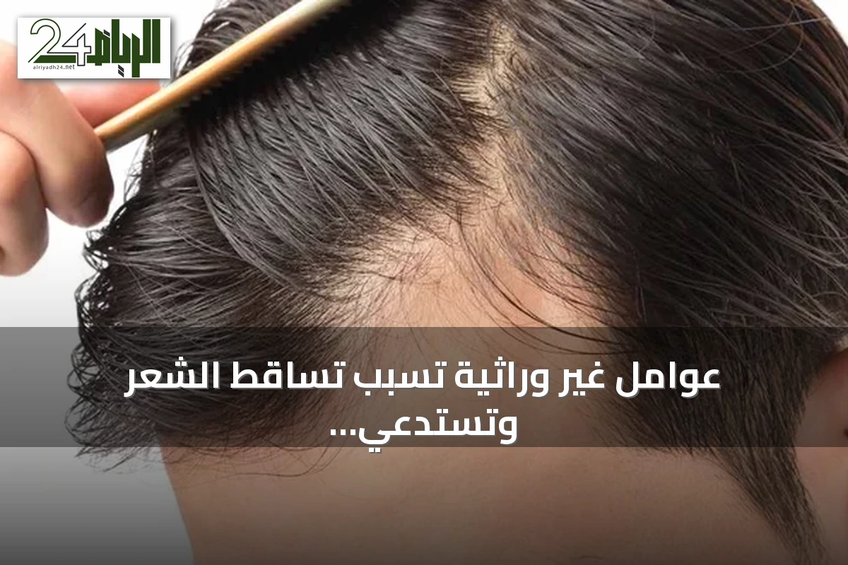 عوامل غير وراثية تسبب تساقط الشعر وتستدعي الانتباه