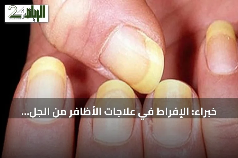 خبراء: الإفراط في علاجات الأظافر من الجل إلى الأكريليك يهدد صحتها