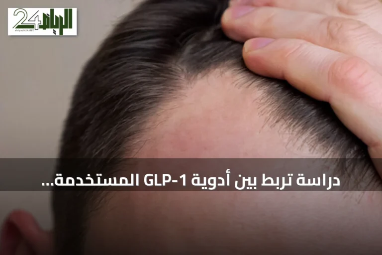 دراسة تربط بين أدوية GLP-1 المستخدمة لعلاج السمنة وتساقط الشعر الوراثي لدى الرجال