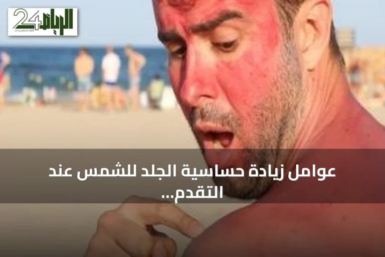 عوامل زيادة حساسية الجلد للشمس عند التقدم في السن