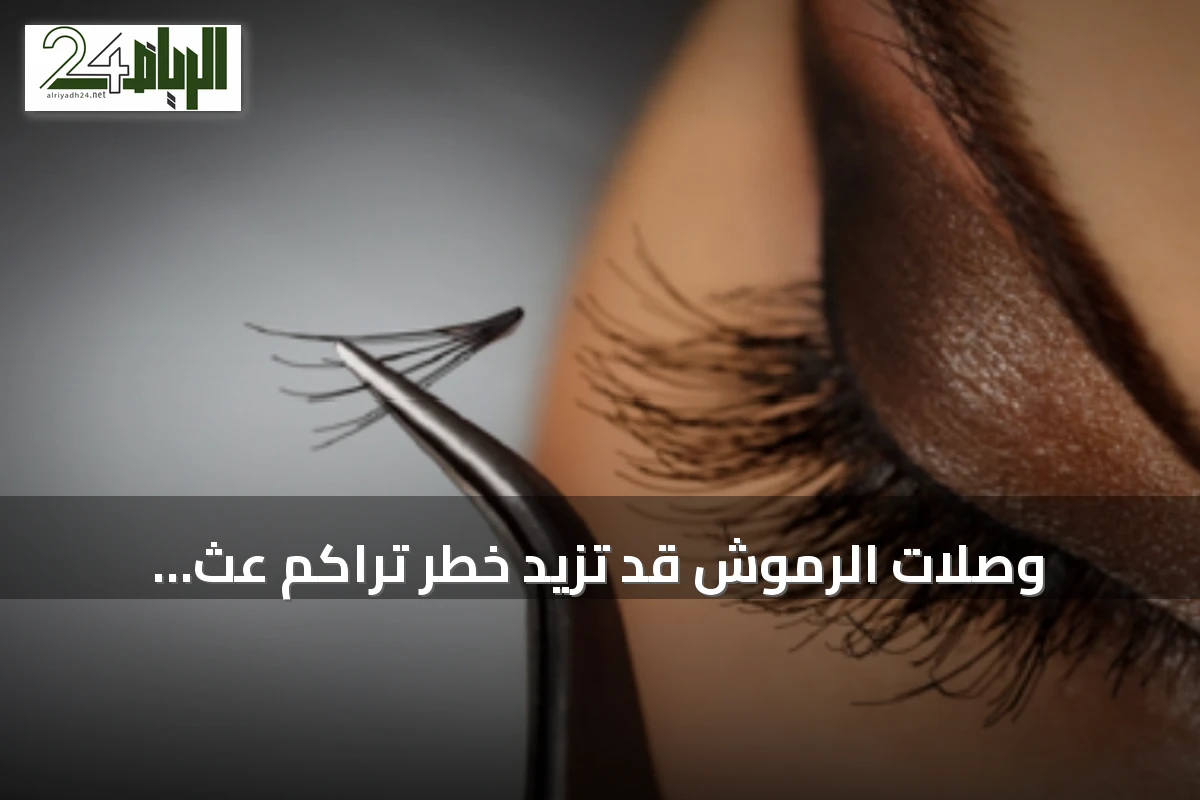 وصلات الرموش قد تزيد خطر تراكم عث ديموديكس وتسبب تهيج العين وتقشر الجلد