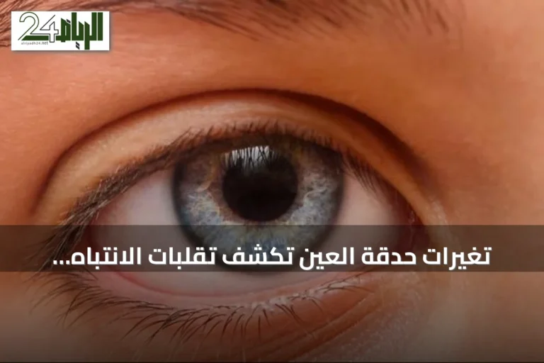 تغيرات حدقة العين تكشف تقلبات الانتباه لدى أطفال ADHD في دراسة واعدة
