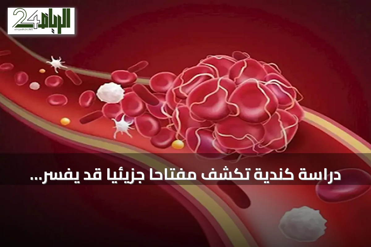 دراسة كندية تكشف مفتاحاً جزيئياً قد يفسر الجلطات الخطيرة المرتبطة بالهيبارين