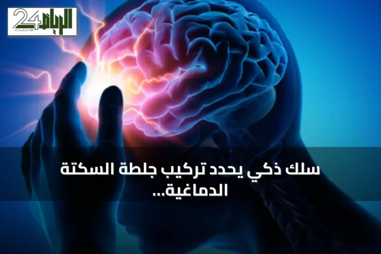 سلك ذكي يحدد تركيب جلطة السكتة الدماغية ويرسم خريطتها في الوقت الفعلي