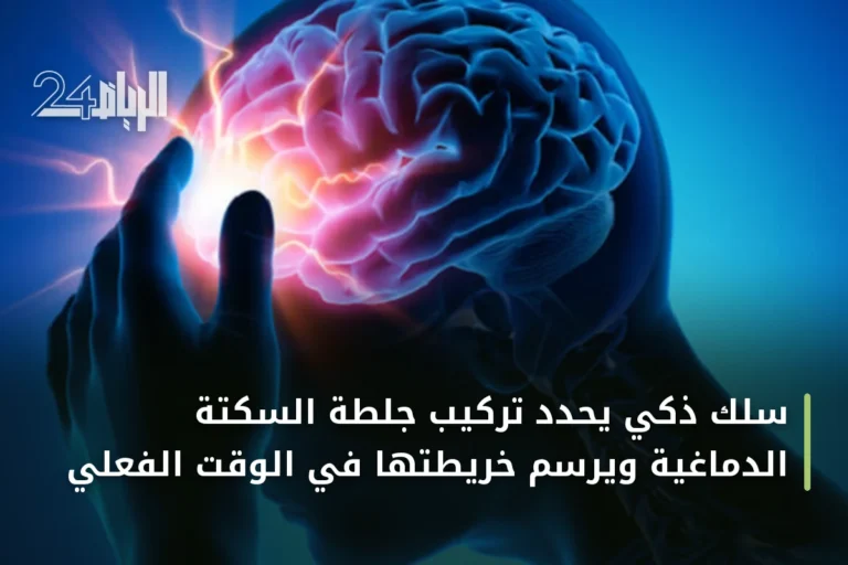 سلك ذكي يحدد تركيب جلطة السكتة الدماغية ويرسم خريطتها في الوقت الفعلي