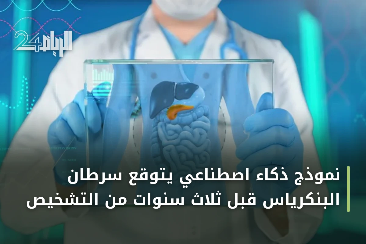 نموذج ذكاء اصطناعي يتوقع سرطان البنكرياس قبل ثلاث سنوات من التشخيص