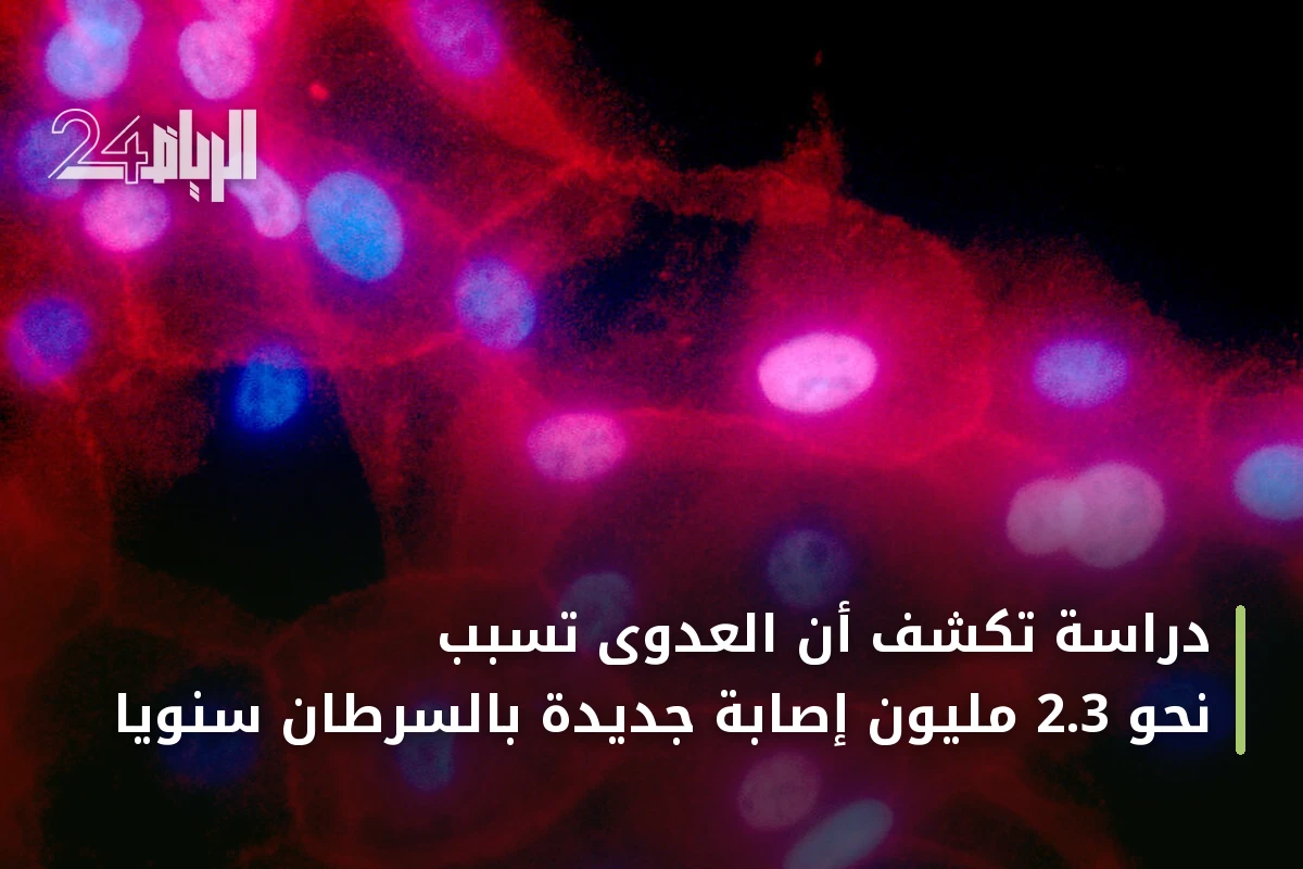 دراسة تكشف أن العدوى تسبب نحو 2.3 مليون إصابة جديدة بالسرطان سنوياً