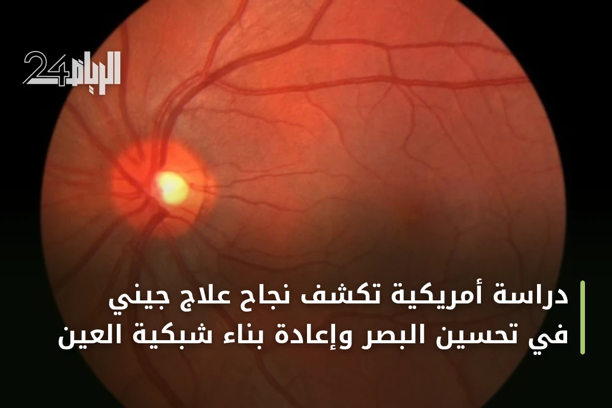 دراسة أمريكية تكشف نجاح علاج جيني في تحسين البصر وإعادة بناء شبكية العين