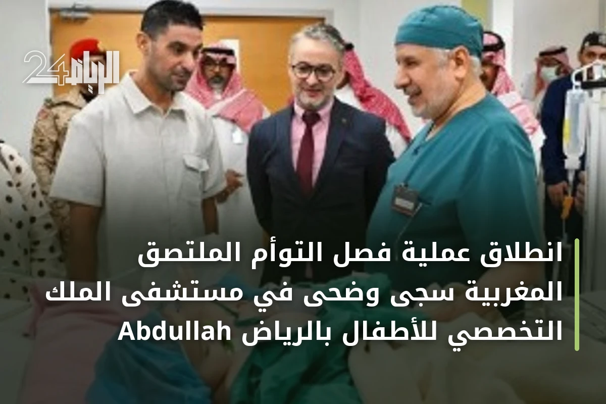 انطلاق عملية فصل التوأم الملتصق المغربية سجى وضحى في مستشفى الملك Abdullah التخصصي للأطفال بالرياض