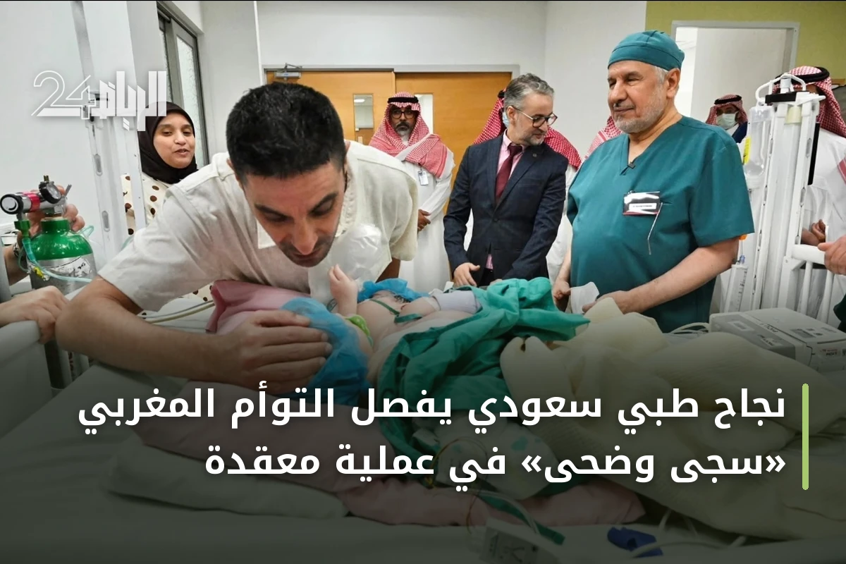 نجاح طبي سعودي يفصل التوأم المغربي «سجى وضحى» في عملية معقدة