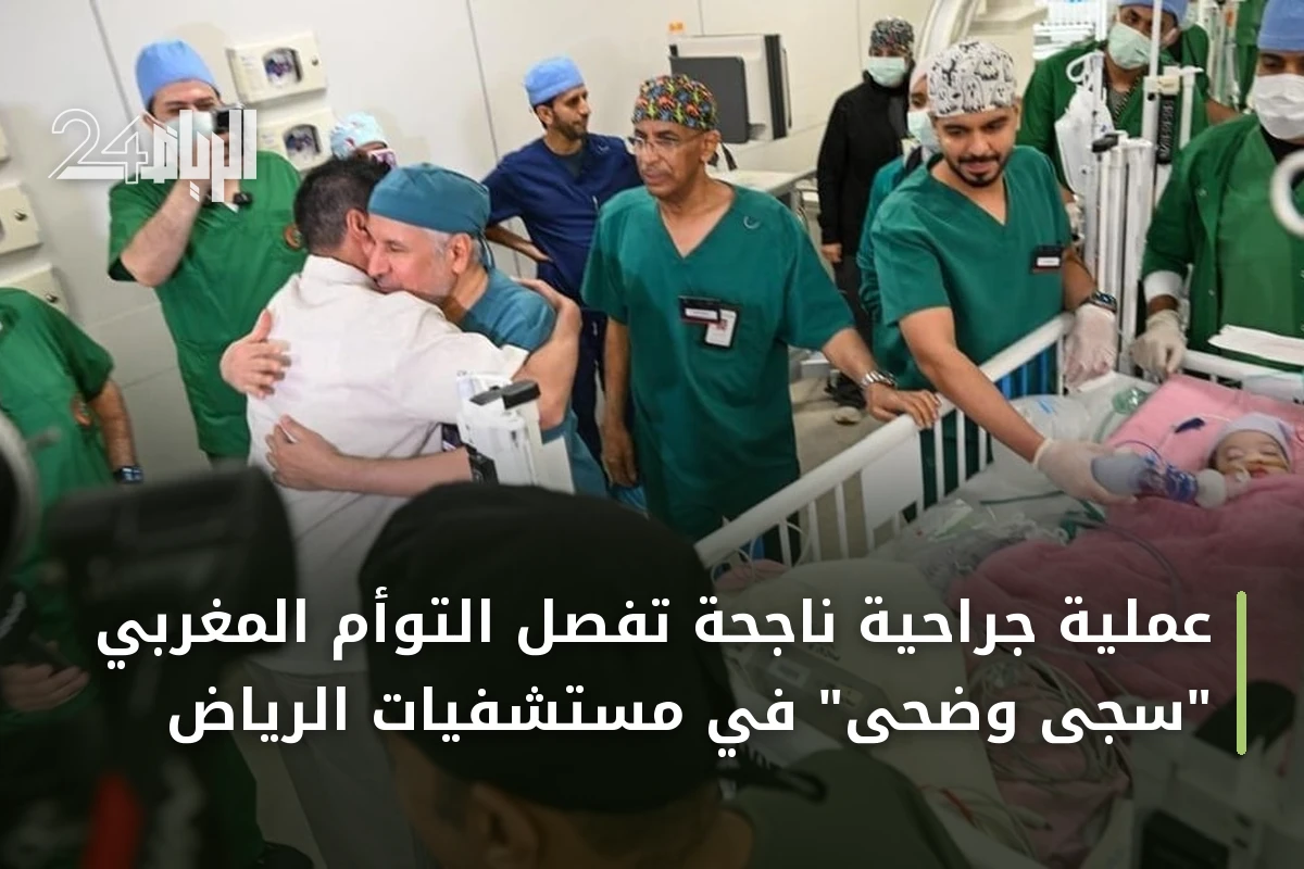 عملية جراحية ناجحة تفصل التوأم المغربي "سجى وضحى" في مستشفيات الرياض