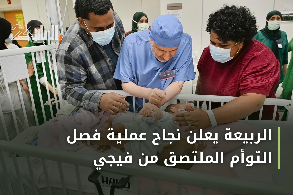 الربيعة يعلن نجاح عملية فصل التوأم الملتصق من فيجي