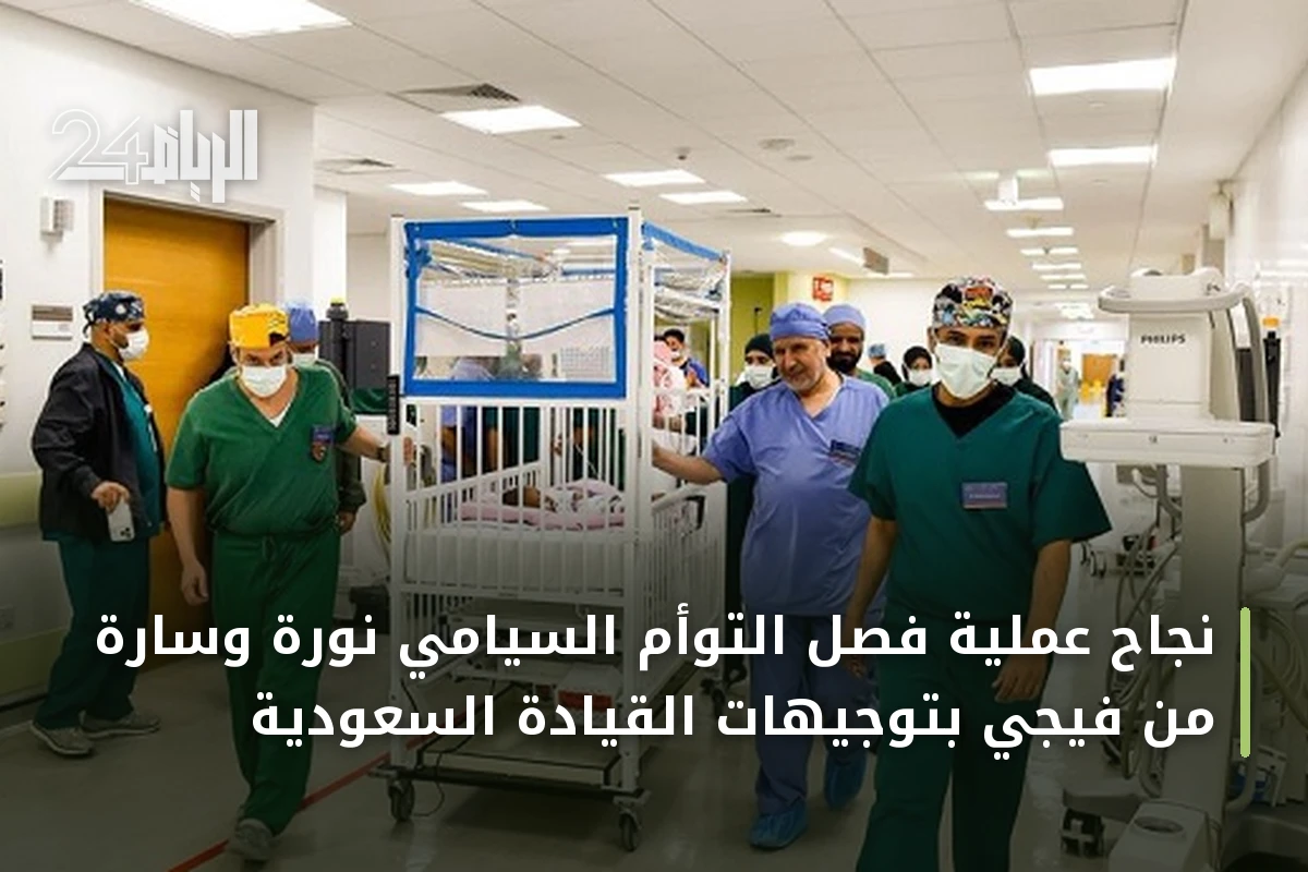 نجاح عملية فصل التوأم السيامي نورة وسارة من فيجي بتوجيهات القيادة السعودية